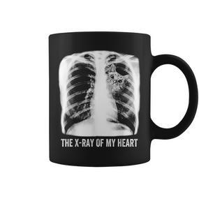 Das Röntgenbild Meiner Herzkatze Tassen - Seseable De