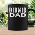 Bionic Dad Fun Hip Or Knee Replacement Joint Replacement Coffee Mug Gifts ideas