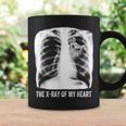 Das Röntgenbild Meiner Herzkatze Tassen Geschenkideen